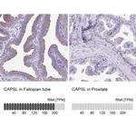 CAPSL Antibody in Immunohistochemistry (IHC)