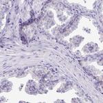 CAPSL Antibody in Immunohistochemistry (IHC)