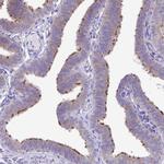 CAPSL Antibody in Immunohistochemistry (IHC)