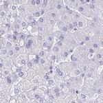 CAPSL Antibody in Immunohistochemistry (IHC)