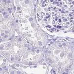 CAPSL Antibody in Immunohistochemistry (IHC)
