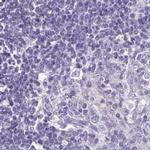 CAPSL Antibody in Immunohistochemistry (IHC)