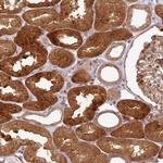 ATAT1 Polyclonal Antibody