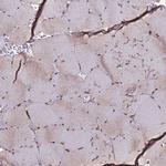 CLK3 Antibody in Immunohistochemistry (Paraffin) (IHC (P))