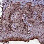 CLK3 Antibody in Immunohistochemistry (Paraffin) (IHC (P))