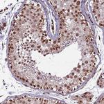 CLK3 Antibody in Immunohistochemistry (Paraffin) (IHC (P))