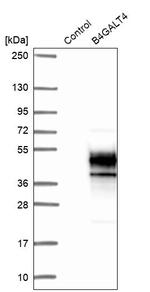 B4GALT4 Antibody in Western Blot (WB)