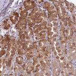 SFRS19 Polyclonal Antibody