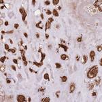 FAM47B Antibody in Immunohistochemistry (Paraffin) (IHC (P))