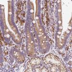 DDOST Antibody in Immunohistochemistry (Paraffin) (IHC (P))