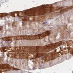 RASL10B Polyclonal Antibody