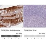 RASL10B Antibody in Immunohistochemistry (IHC)