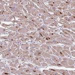 PLCXD3 Antibody in Immunohistochemistry (Paraffin) (IHC (P))