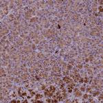 PLCXD3 Antibody in Immunohistochemistry (Paraffin) (IHC (P))