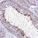 PLCXD3 Antibody in Immunohistochemistry (Paraffin) (IHC (P))