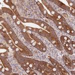 UQCC3 Antibody in Immunohistochemistry (Paraffin) (IHC (P))