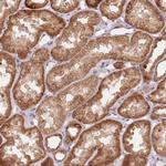UQCC3 Antibody in Immunohistochemistry (Paraffin) (IHC (P))