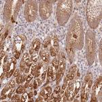 UQCC3 Antibody in Immunohistochemistry (Paraffin) (IHC (P))