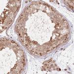 UQCC3 Polyclonal Antibody