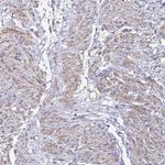 MYL6 Polyclonal Antibody