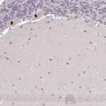 KBTBD6 Antibody in Immunohistochemistry (IHC)