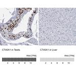 CT45A Antibody in Immunohistochemistry (Paraffin) (IHC (P))