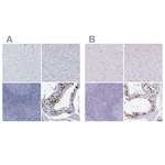 CT45A Antibody in Immunohistochemistry (Paraffin) (IHC (P))