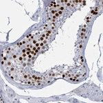CT45A Antibody in Immunohistochemistry (Paraffin) (IHC (P))