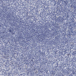 CT45A Antibody in Immunohistochemistry (Paraffin) (IHC (P))