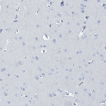 CT45A Antibody in Immunohistochemistry (Paraffin) (IHC (P))