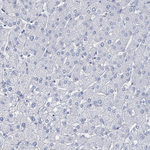 CT45A Antibody in Immunohistochemistry (Paraffin) (IHC (P))