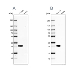 CT45A Antibody in Western Blot (WB)