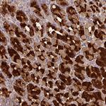 PGA3 Polyclonal Antibody