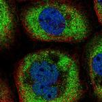 LGALS9B Polyclonal Antibody