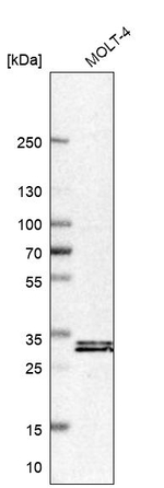 LGALS9B Antibody in Western Blot (WB)