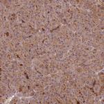 FAM148B Polyclonal Antibody