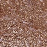 KIF26A Antibody in Immunohistochemistry (Paraffin) (IHC (P))