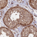KIF26A Antibody in Immunohistochemistry (Paraffin) (IHC (P))