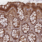 KIF26A Antibody in Immunohistochemistry (Paraffin) (IHC (P))