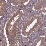 GNPDA1 Antibody in Immunohistochemistry (Paraffin) (IHC (P))