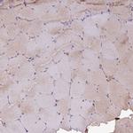 GNPDA1 Antibody in Immunohistochemistry (Paraffin) (IHC (P))