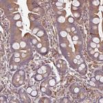 GNPDA1 Antibody in Immunohistochemistry (IHC)