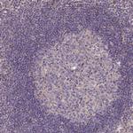 FAM89B Polyclonal Antibody