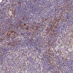MAGEF1 Polyclonal Antibody