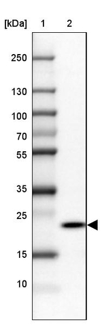 RPP25 Antibody in Western Blot (WB)