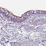 NWD2 Polyclonal Antibody