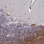 TCEANC2 Antibody in Immunohistochemistry (Paraffin) (IHC (P))