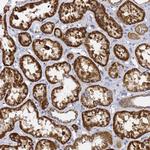 C19orf12 Antibody in Immunohistochemistry (Paraffin) (IHC (P))