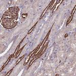 mPR alpha Antibody in Immunohistochemistry (Paraffin) (IHC (P))