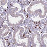 TTPAL Antibody in Immunohistochemistry (Paraffin) (IHC (P))